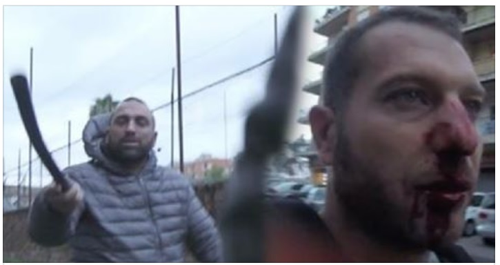 ROMA,GIORNALISTA AGGREDITO DA ESPONENTE DEL CLAN SPADA: IL MODO IN CUI GLI SPACCA IL NASO E' ATROCE - VIDEO - 08/11/2017